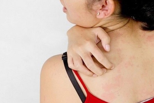 冬季如何预防皮肤瘙痒? 中医对付皮肤瘙痒有哪些方法？